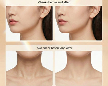 DermaLuxe Contour Facial Roller