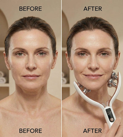 DermaLuxe Contour Pro Facial Roller